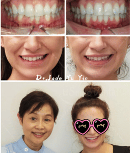 Original uSmile Dental smile gallery image 20, shown in full