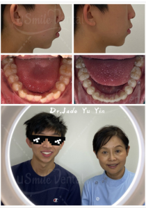 Original uSmile Dental smile gallery image 17, shown in full