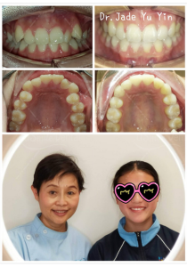 Original uSmile Dental smile gallery image 3, shown in full