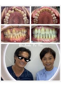 Original uSmile Dental smile gallery image 5, shown in full