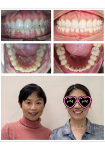 Original uSmile Dental smile gallery image 10, shown in full