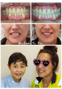 Original uSmile Dental smile gallery image 12, shown in full