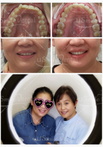 Original uSmile Dental smile gallery image 14, shown in full